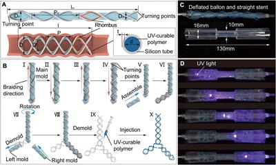 A single-tube-braided stent for various airway structures